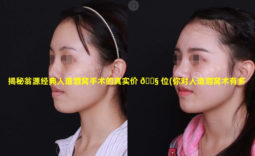 揭秘翁源经典人造酒窝手术的真实价 🐧 位(你对人造酒窝术有多少了解(图))